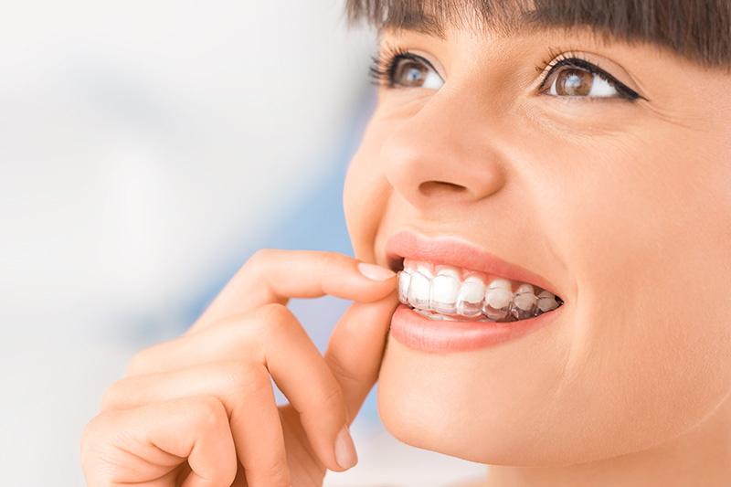 Invisalign in Huntington Beach
