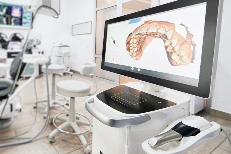 Intra-Oral Scanner in Huntington Beach